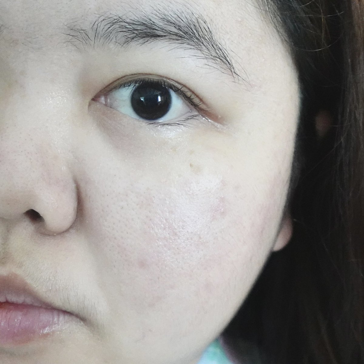 เอาจริงนะ สิ่งนี้ทุกคนต้องมีไว้ใช้ปราบสิวค่ะค่ะ! ใช้มาตั้งแต่วัยรุ่นนะ Effaclar Duo+M ของลาโรช เป็นมอยเจอร์ไรเซอร์ที่บำรุงได้ ปลอบประโลมผิวดี ลดสิวจากต้นตอ เพราะมีตัว PHYLOBIOMA โมเลกุลที่ช่วยปรับสมดุลผิว ลดความมัน ทำให้ช่วยลดการเกิดสิว แล้วช่วยลดรอยจากสิวด้วย ก็คือครบ จบ หมดก็ซื้อวนไป หลอดที่ n 🙌🏻 ต้องมี ต้องซื้อ ต้องซ้ำ !