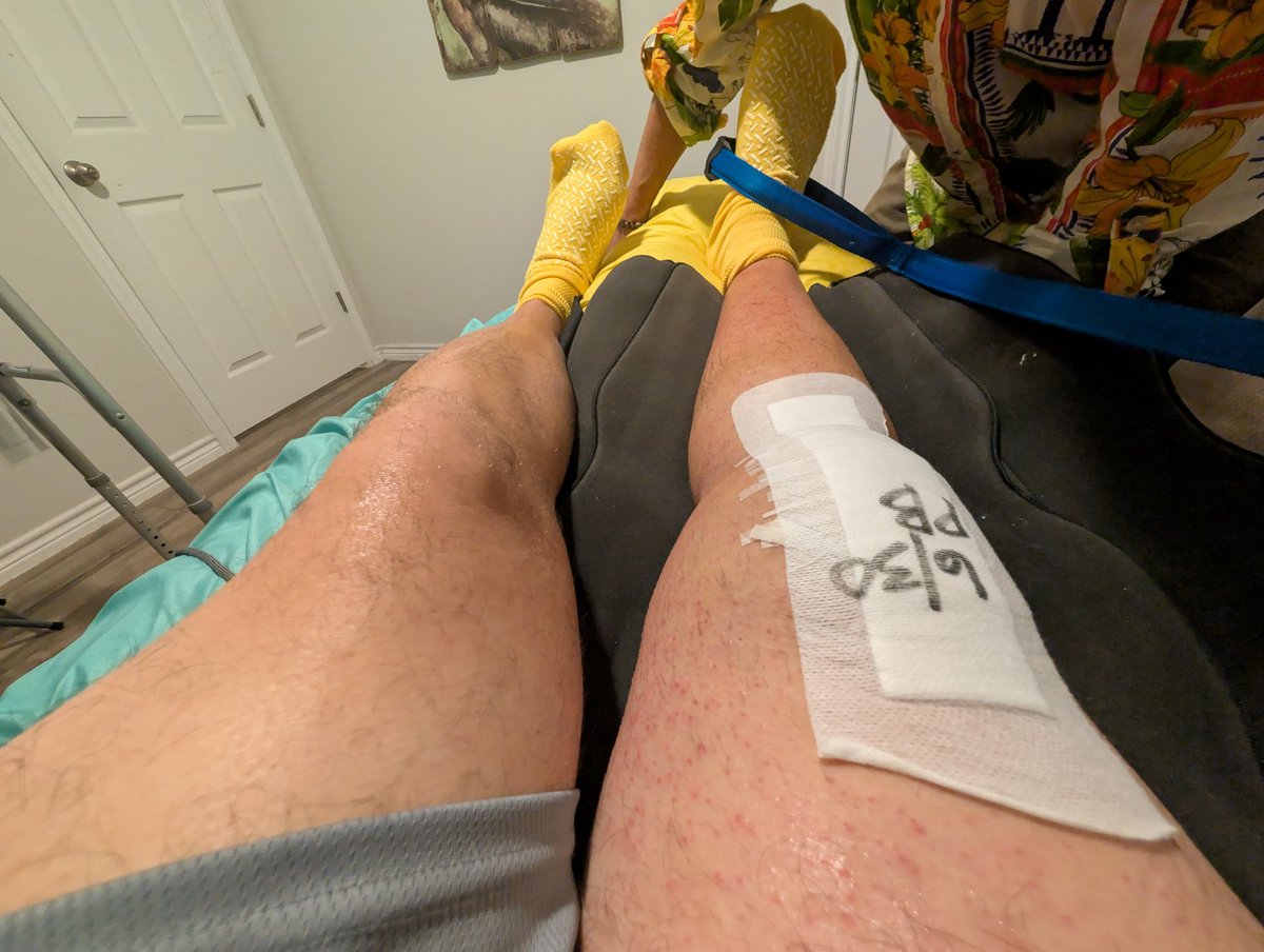 Bud_Fury's tweet photo. Stuck at home for a while. Might buy a switch 2 now. Costa Rica and Colombia beaches are not looking possible this year. Ahhhhh
#knee #surgery #nodriving https://t.co/A7FpKiC2AR