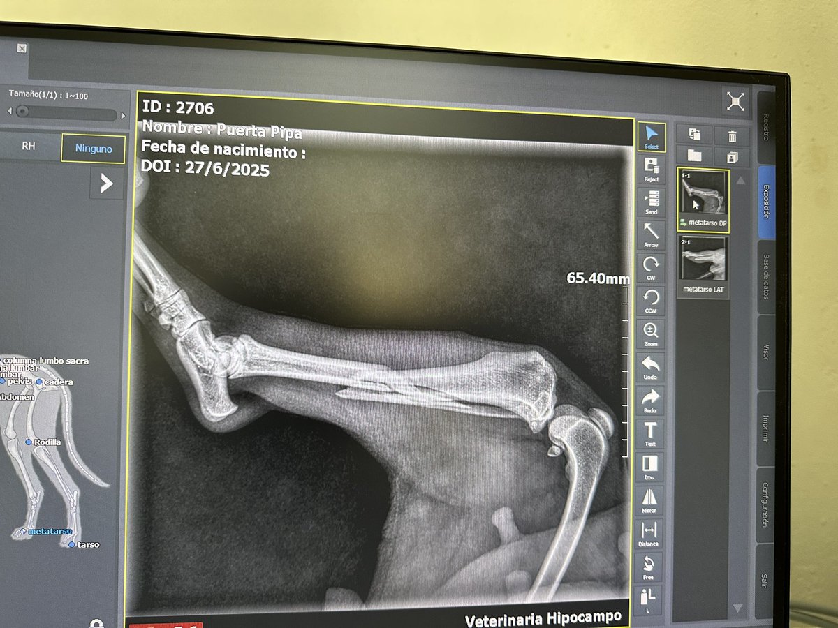 Me cuesta mucho pedir ayuda; pero lo voy a hacer.
Tengo una perrita rescatada con quebradura de tibia y peroné, con 10 años y pesa 8kg.Saqué rx y le inmovilicé su pierna. Necesito cotizaciones de cirugía, Z Norte de Baires. Me pasaron entre 600 mil y 1,2 mill
No pido $ sólo rtw🙏🏾
