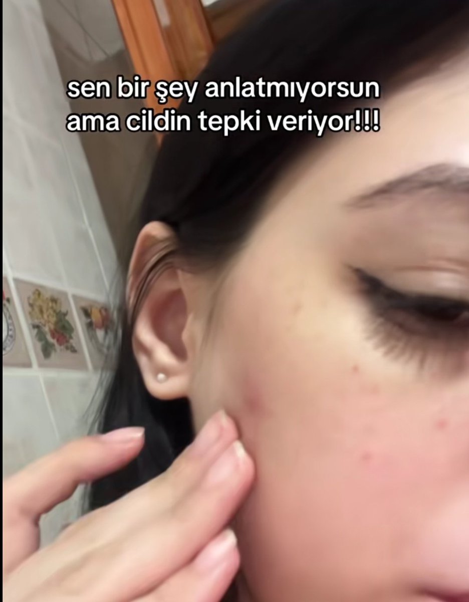 ANLIK (@anlikmod) on Twitter photo 
