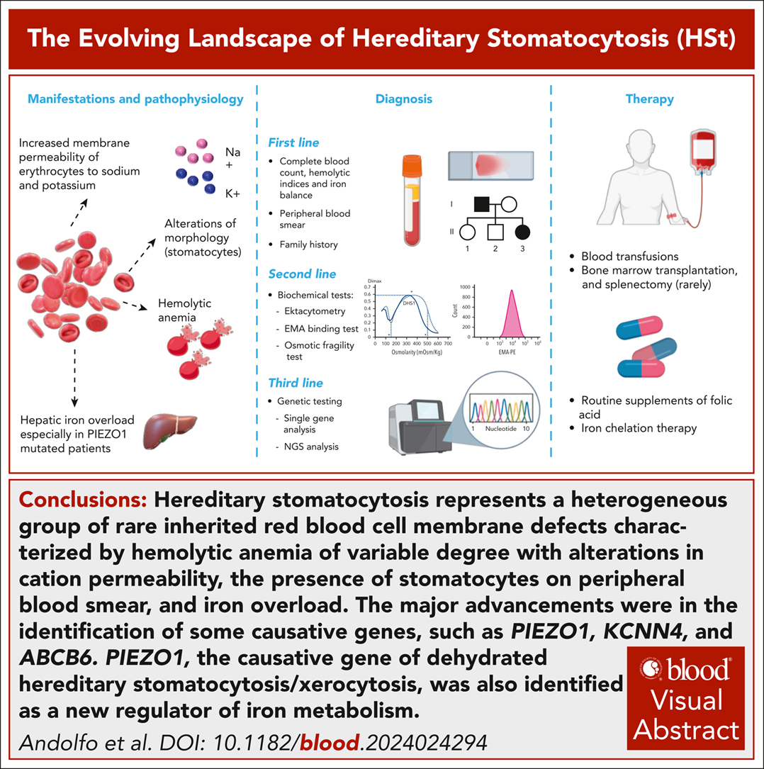 Blood Journal (@bloodjournal) on Twitter photo Hereditary stomatocytosis is a group of inherited human hemolytic anemias characterized by increased membrane permeability (leak) of red blood cells to sodium and potassium. ow.ly/TwJR50WhN5M #redcellsironanderythropoiesis Hereditary stomatocytosis is a group of inherited human hemolytic anemias characterized by increased membrane permeability (leak) of red blood cells to sodium and potassium. ow.ly/TwJR50WhN5M #redcellsironanderythropoiesis
