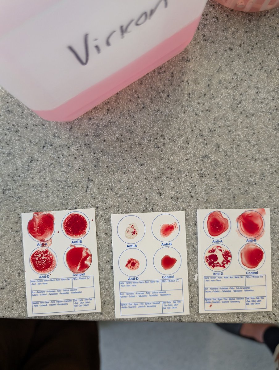 Miss Bird (@missbird90) on Twitter photo We enjoyed our extracurricular this lunch working out which sixth formers I can hit up for a blood donation should I need one. We enjoyed our extracurricular this lunch working out which sixth formers I can hit up for a blood donation should I need one.