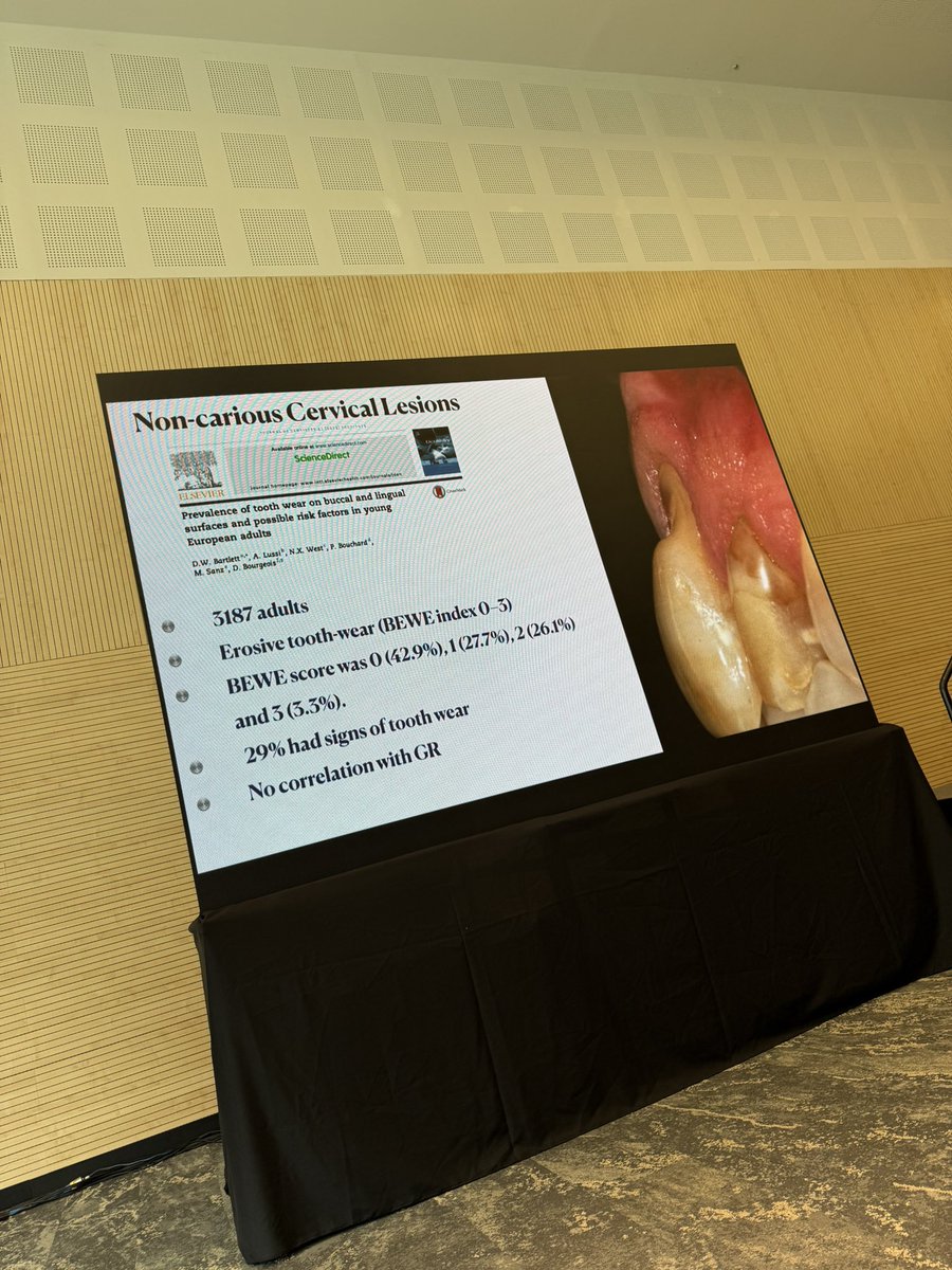 PerioMX's tweet image. Son muy frecuentes las lesiones cervicales no cariosas en recesiones gingivales pero no se pueden correlacionar 
#DrMarianoSanz