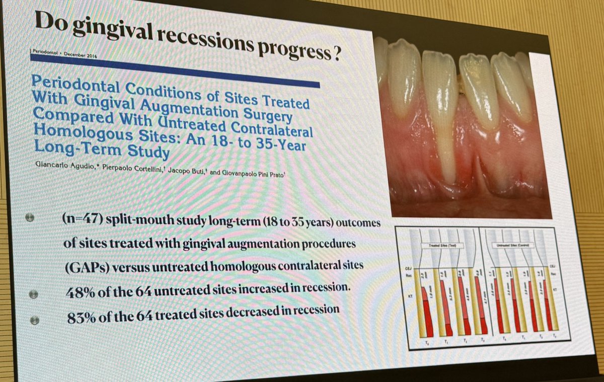 PerioMX's tweet image. Las recesiones gingivales tienden a progresar según Pini Prato