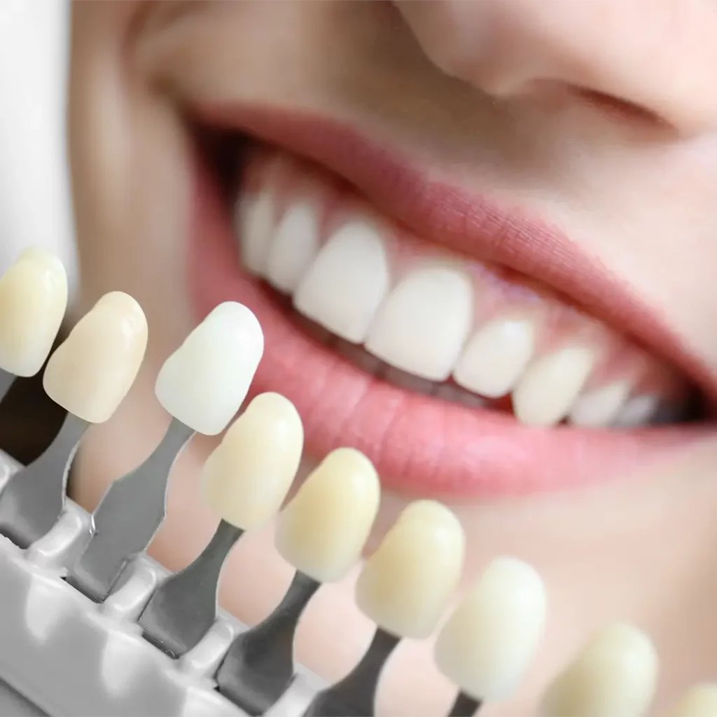 Living Optics (@livingoptics) on Twitter photo Shade matching in #dentistry is harder than it looks. 
This case study explores the use of our snapshot #hyperspectral #imaging camera to Improve efficiency, accuracy & patient satisfaction.
Read how hyperspectral imaging could transform cosmetic dentistry livingoptics.com/hyperspectral-… Shade matching in #dentistry is harder than it looks. 
This case study explores the use of our snapshot #hyperspectral #imaging camera to Improve efficiency, accuracy & patient satisfaction.
Read how hyperspectral imaging could transform cosmetic dentistry livingoptics.com/hyperspectral-…