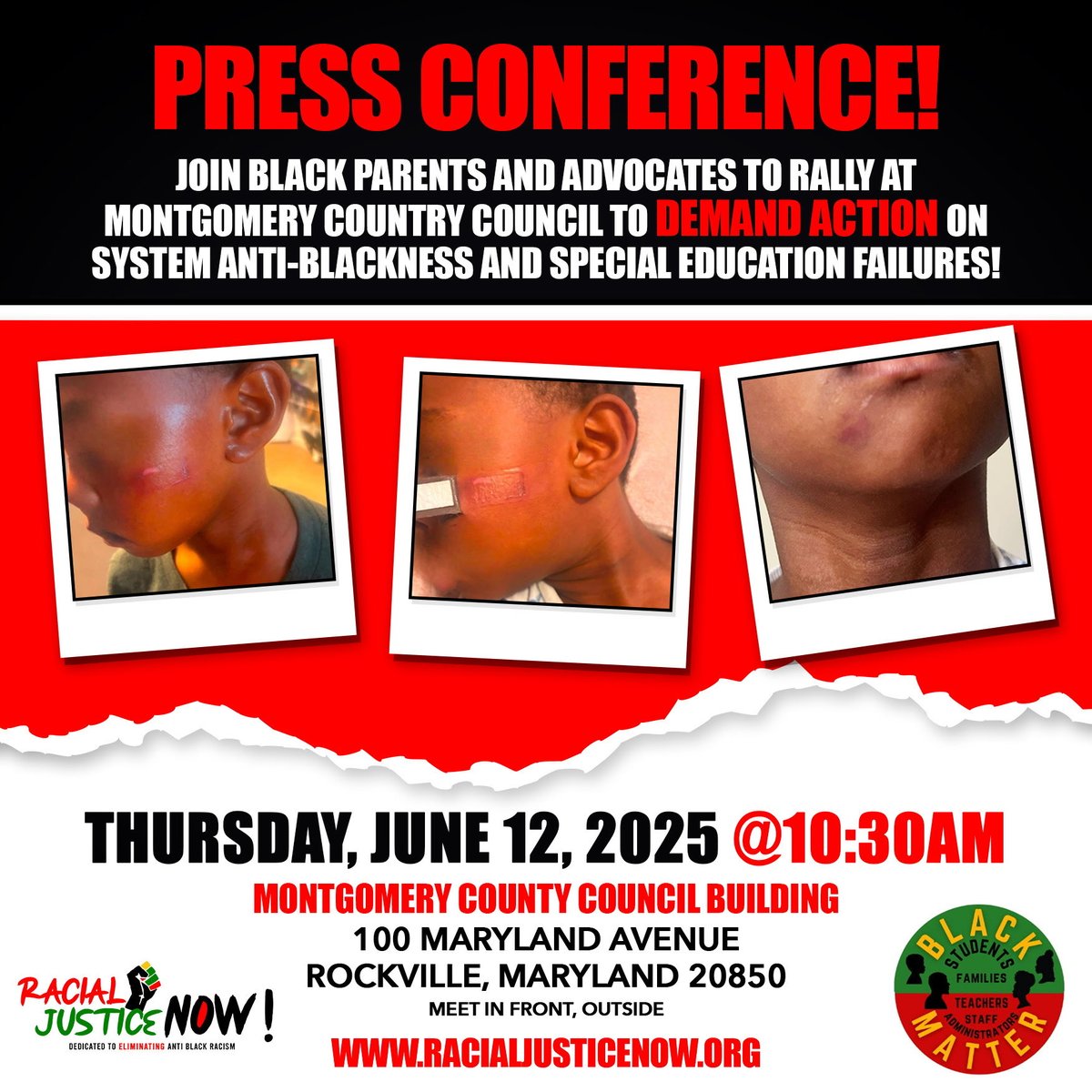 Racial Justice NOW! ๐ฆ๐พ๐ง๐พ (@racialjsticenow) on Twitter photo <a href="/RacialJsticeNow/">Racial Justice NOW! ๐ฆ๐พ๐ง๐พ</a> & community leaders hosted a press conf. on 6/12 in Rockville, MD to demand urgent action in response to systemic anti-Blackness, widespread special education non-compliance and continued harm <a href="/MoCoCouncilMD/">Montgomery Council</a> <a href="/mocoboe/">Moco BOE</a>
racialjusticenow.org/press-conferenโฆ <a href="/RacialJsticeNow/">Racial Justice NOW! ๐ฆ๐พ๐ง๐พ</a> & community leaders hosted a press conf. on 6/12 in Rockville, MD to demand urgent action in response to systemic anti-Blackness, widespread special education non-compliance and continued harm <a href="/MoCoCouncilMD/">Montgomery Council</a> <a href="/mocoboe/">Moco BOE</a>
racialjusticenow.org/press-conferenโฆ