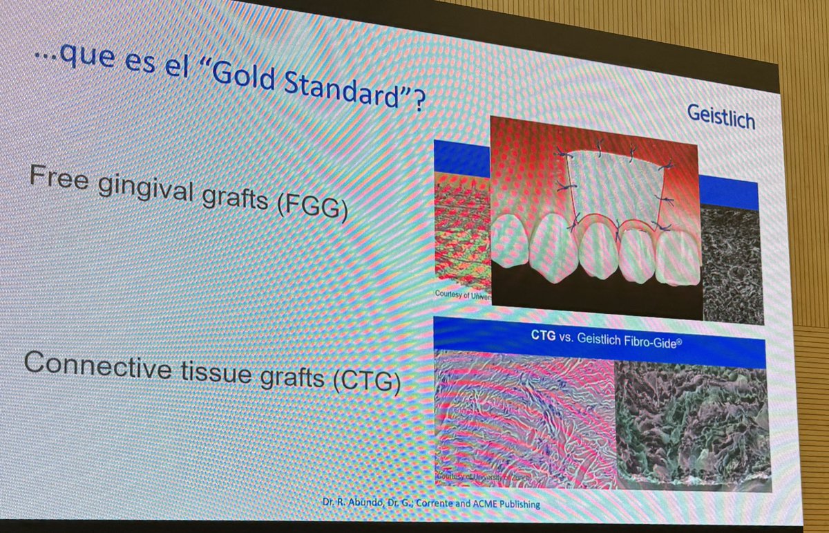 PerioMX's tweet photo. Ya llegaron los sustitutos de tejido blando por parte de #geistlich con @coadental para todo México https://t.co/q6sQr22K12