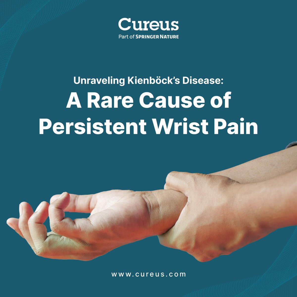 Unresolved Wrist Pain in a Young Adult

A 26-year-old woman with persistent wrist pain was diagnosed with Kienböck’s disease—a rare avascular necrosis of the lunate.

Read the full article: hubs.la/Q03vDQb_0

#KienbocksDisease #Orthopedics #WristPain #CaseReport