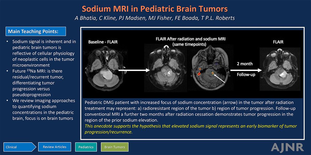 Sodium MRI in Pediatric Brain Tumors
Open Access
ajnr.org/content/46/7/1…
<a href="/TheAJNR/">AJNR</a>