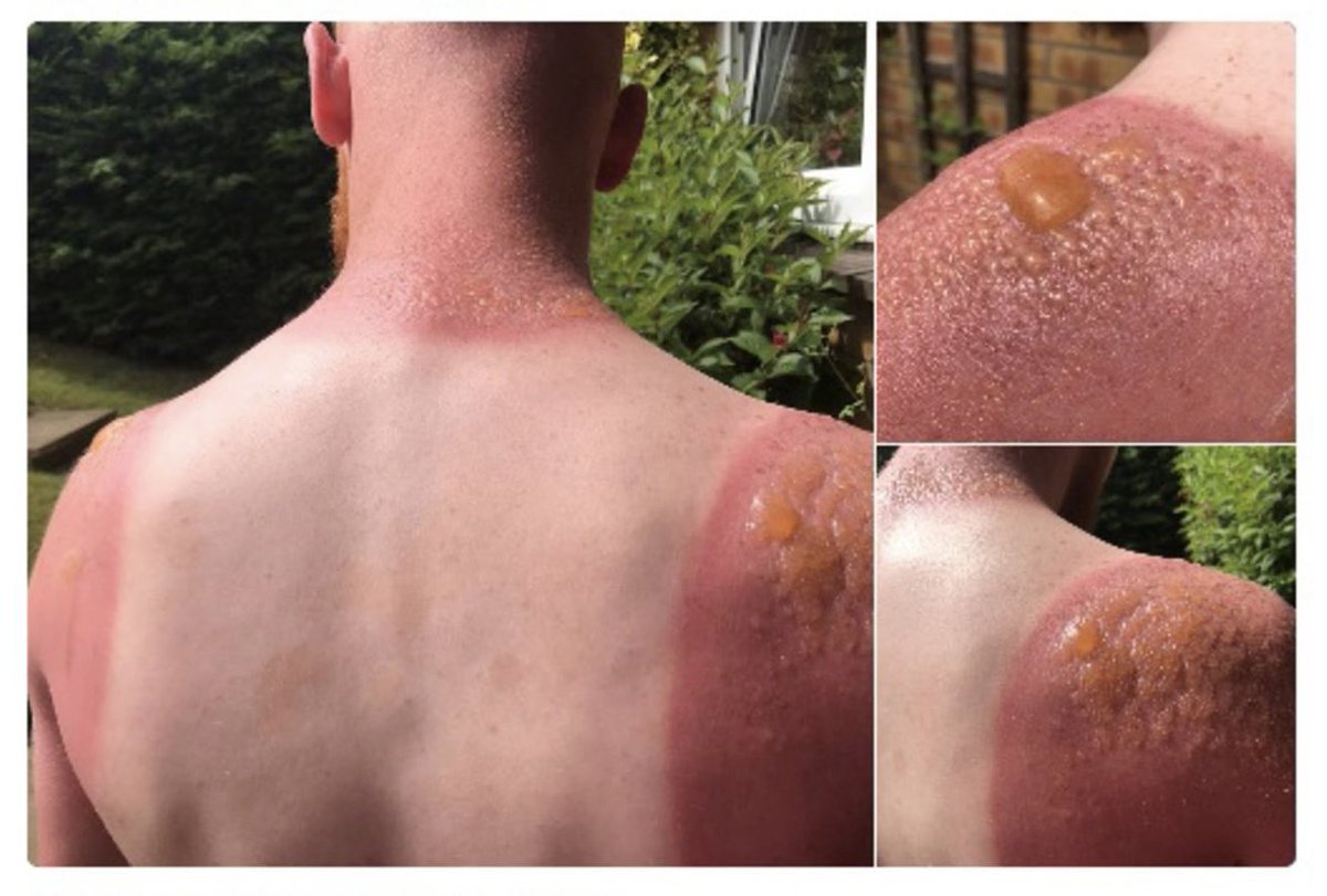 Ness 🦋 tweet media