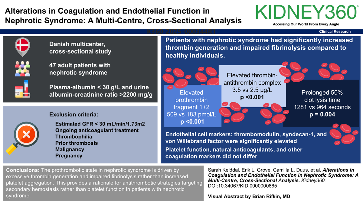 Nephrotic syndrome is associated with excessive thrombin generation and impaired fibrinolysis, increasing risk of thrombosis. kidney.pub/KID0865 #ASNKidney360