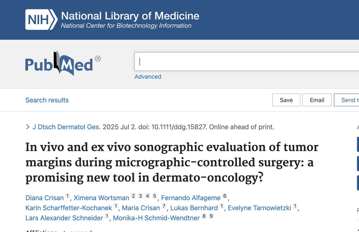 🩺✨ New Publication Alert: Ultrasound for Detecting Tumor in Vivo and Ex Vivo Margins inSkin Cancer Surgery!
A recent study investigated the in vivo and ex vivo use of high-frequency ultrasound (HFUS) to evaluate tumor margins during micrographic-controlled surgery (MCS) for