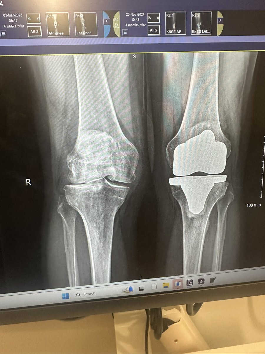 I feel like the one on the left is headed toward the one on the right….dammit