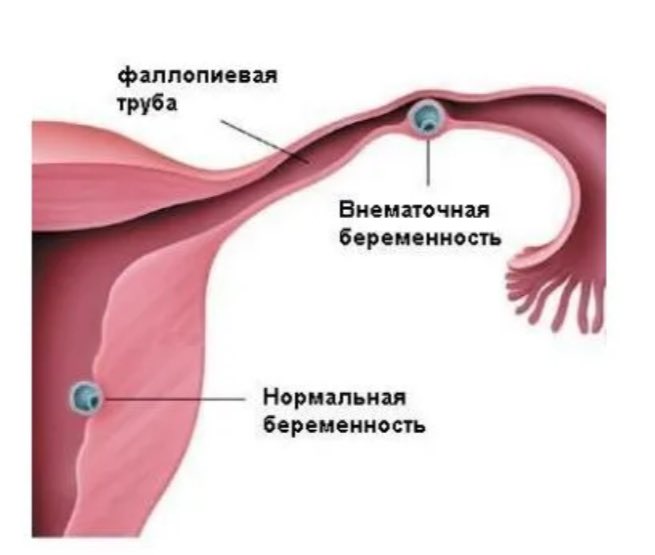 твоя милая сколопендра tweet media