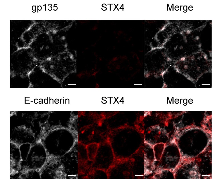 endothelialnews's tweet image. Collaborators found that the interaction between VAMP3 on TfR vesicles and syntaxin 4 at the basolateral membrane of brain microvascular #endothelial cells mediates the final fusion step of TfR transcytosis.
馃搷 Now in @PNASNews!
bit.ly/3Ip9VOm