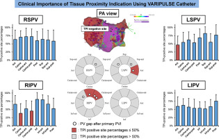 Clinical Importance of Tissue Proximity Indication During Pulsed Field Ablation for Atrial Fibrillation: Insights from Initial Experience

heartrhythmjournal.com/article/S1547-…