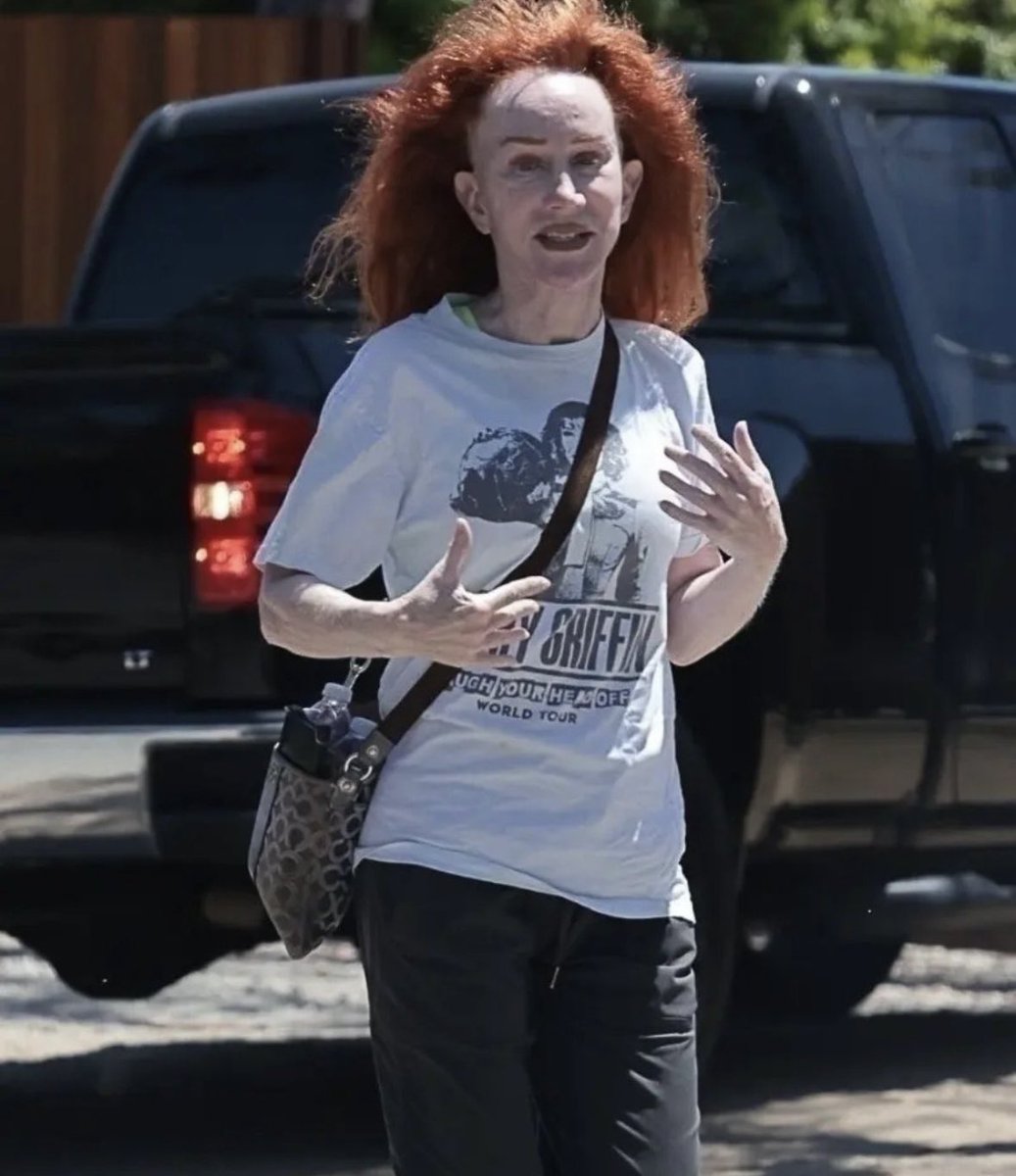 Kathy Griffin is looking ROUGH

This is what happens when you fall victim to Trump Derangement Syndrome:
