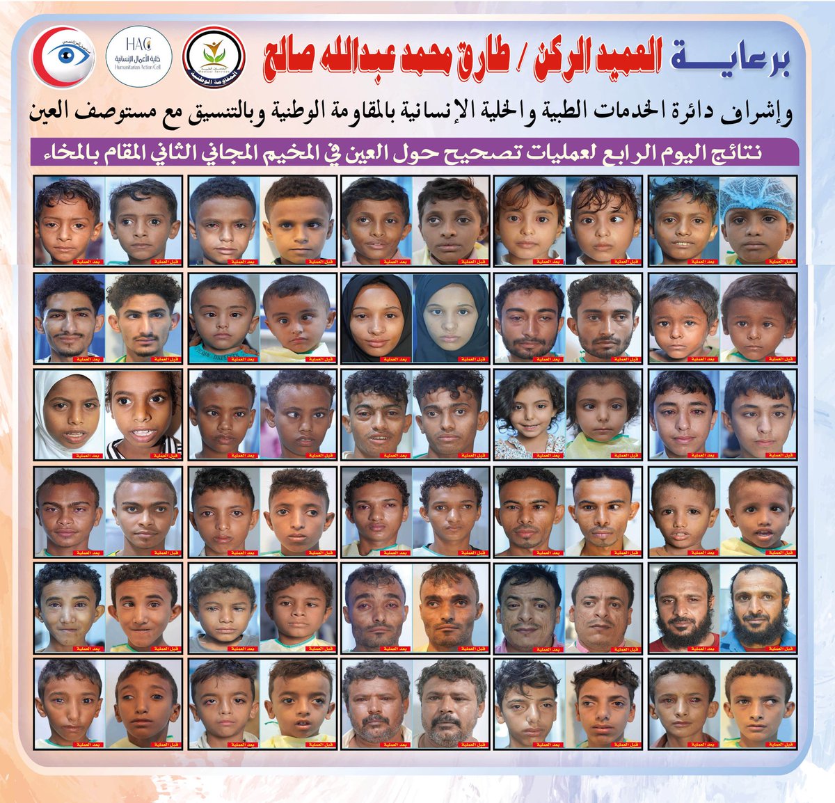 نتائج اليوم الأربعاء المخيم الثاني لحول العين 
في المستشفى السعودي الميداني بالمخاء