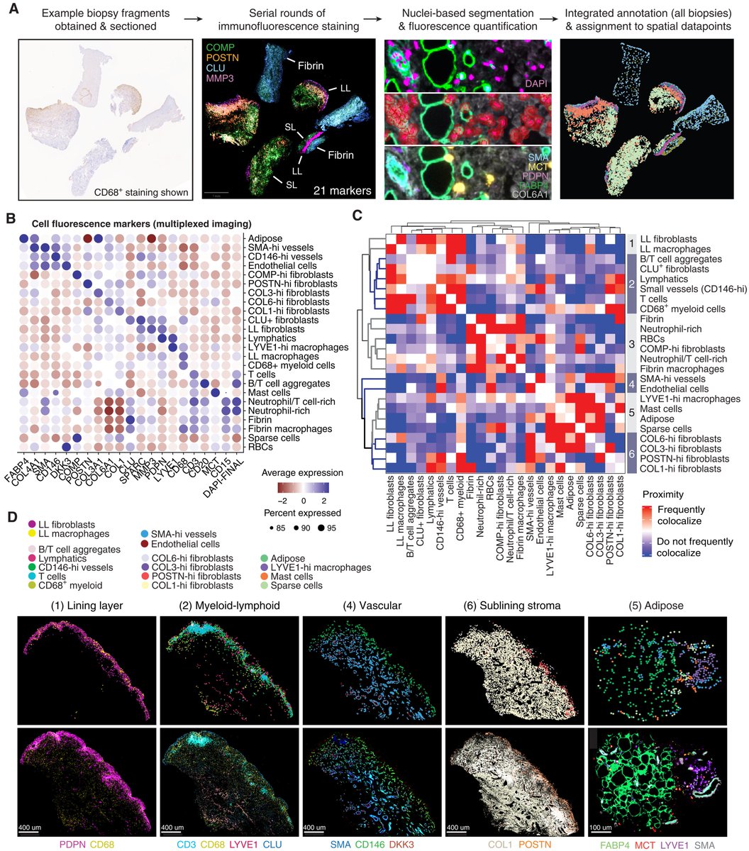 Waggoner Lab (@labwaggoner) on Twitter photo An atlas of the cellular and molecular landscape of the juvenile idiopathic arthritis synovium defines tissue niches associated with disease severity <a href="/ScienceTM/">Science Translational Medicine</a>
science.org/doi/10.1126/sc…
<a href="/WedderburnGroup/">Lucy Wedderburn</a> <a href="/chrissybolton/">chrissyb</a> An atlas of the cellular and molecular landscape of the juvenile idiopathic arthritis synovium defines tissue niches associated with disease severity <a href="/ScienceTM/">Science Translational Medicine</a>
science.org/doi/10.1126/sc…
<a href="/WedderburnGroup/">Lucy Wedderburn</a> <a href="/chrissybolton/">chrissyb</a>