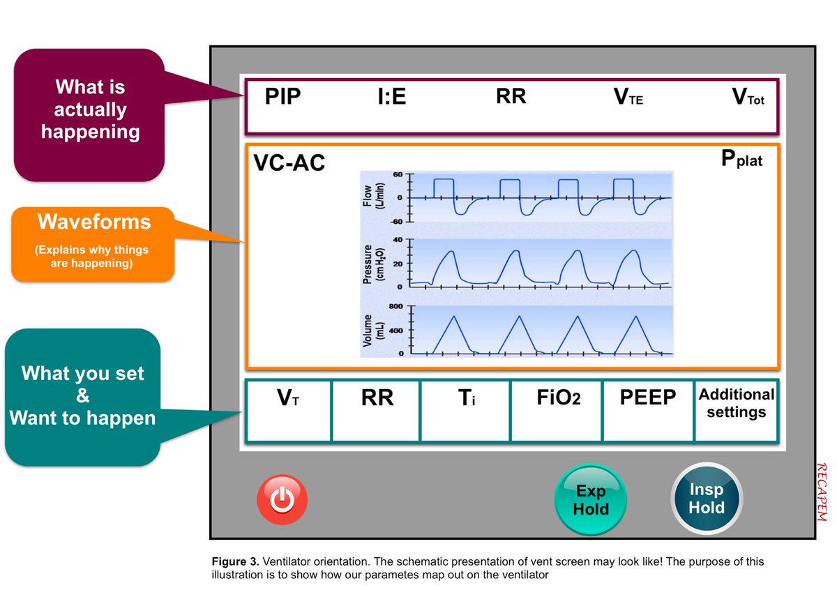 NephroP's tweet photo. Nice review on mechanical ventilation, particularly useful for new residents and fellows starting ICU rotation.
#FOAMed #FOAMcc #ICU 
🔗 https://t.co/f83K16sBK8 https://t.co/poaHaQcAoj
