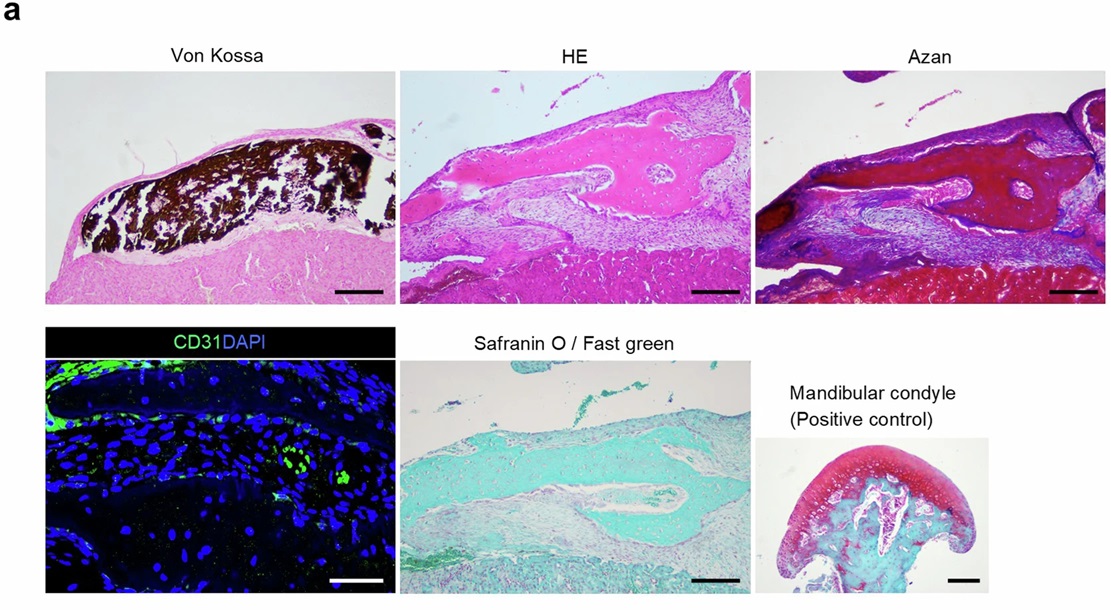 organoidscience's tweet image. Read about jawbones in a dish in this new @Nature study. 🧫
Scientists from Kyoto University present a method for generating jawbone-like #organoids from #hiPSCs through PA1 ectomesenchyme of the mandibular prominence.
go.nature.com/4ewsD2P