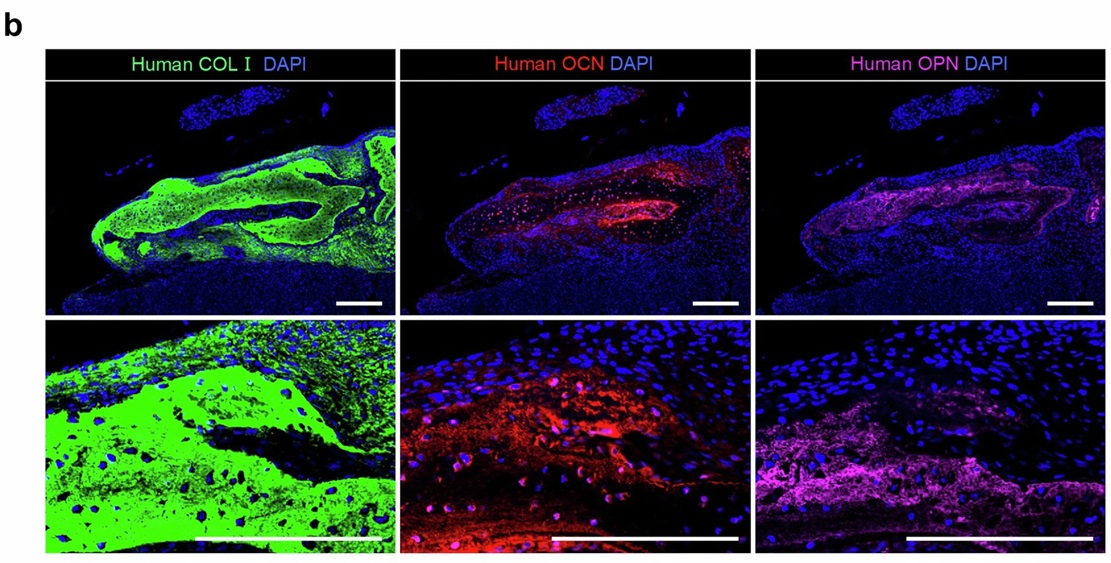organoidscience's tweet image. Read about jawbones in a dish in this new @Nature study. 🧫
Scientists from Kyoto University present a method for generating jawbone-like #organoids from #hiPSCs through PA1 ectomesenchyme of the mandibular prominence.
go.nature.com/4ewsD2P