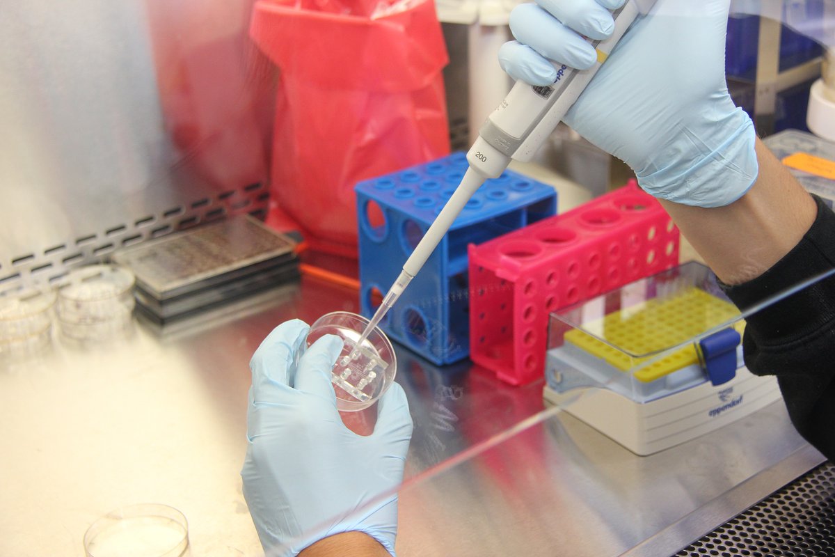 DermalCell's tweet image. Scientists showed that CDKL3 promoted malignant #melanoma progression via targeting autophagy related 5 (ATG5).
CDKL3 induced melanoma cell autophagy through an ATG5-dependent manner.
💡Learn more: bit.ly/40BOxM6