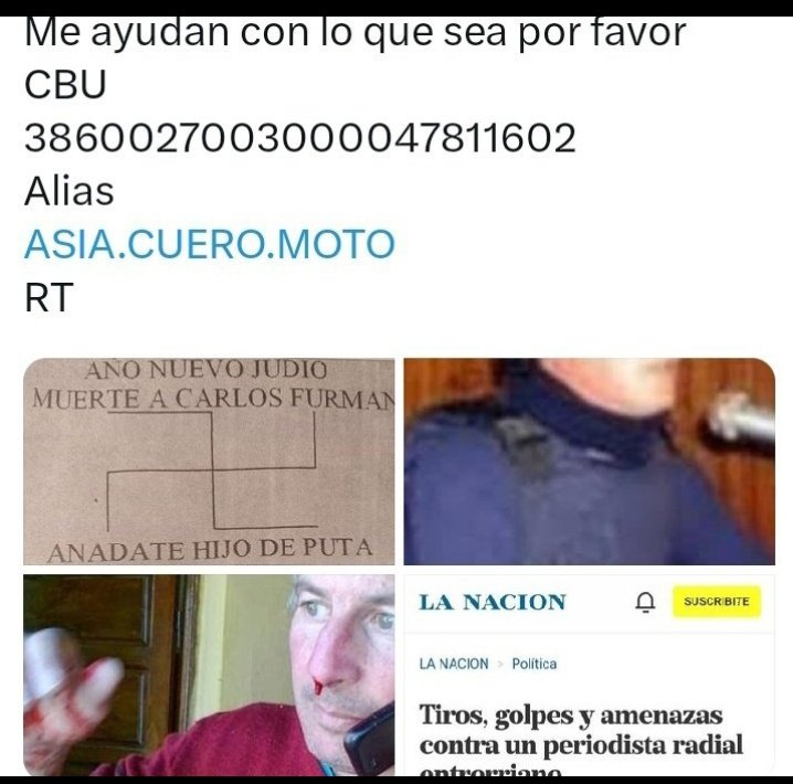 Volviendo de otro día con suero y demás insumos para poder calmar dolores enfermedades incurables e insuficiencia respiratoria severa😔
Cansado de sufrir y de tantas injusticia.
Solo les pido a los que puedan y quieran una limosna y un RT para este twet fijo por el amor de Dios🙏
