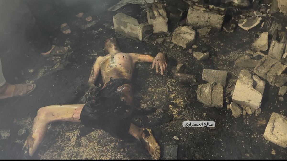 AnasAlSharif0's tweet image. Charred bodies and massive destruction after Israeli forces bombed the Mustafa Hafez School, which was sheltering displaced families. Most of the victims were women and children.