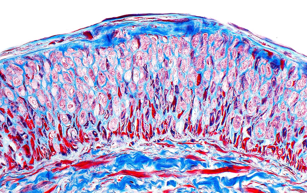 ziad_zaatari's tweet image. 🔬 Artery in a Kidney, Trichrome Stain ~ #Histology #Pathology #RenalPath #PathArt 🎨📸