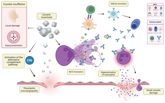 JCM_MDPI's tweet photo. #mdpijcm
#Editor’s Choice Paper🙌
#HighlyReviewed
Cocaine- and Levamisole-Induced #Vasculitis: Defining the Spectrum of #Autoimmune Manifestations
📌https://t.co/Rp7X2uURM5
🏫University of Padua
by Luca Iorio et al. @UnitPadova @FedeDavanzo @roberto_padoan  @MediPharma_MDPI https://t.co/sV3KkjOcXZ