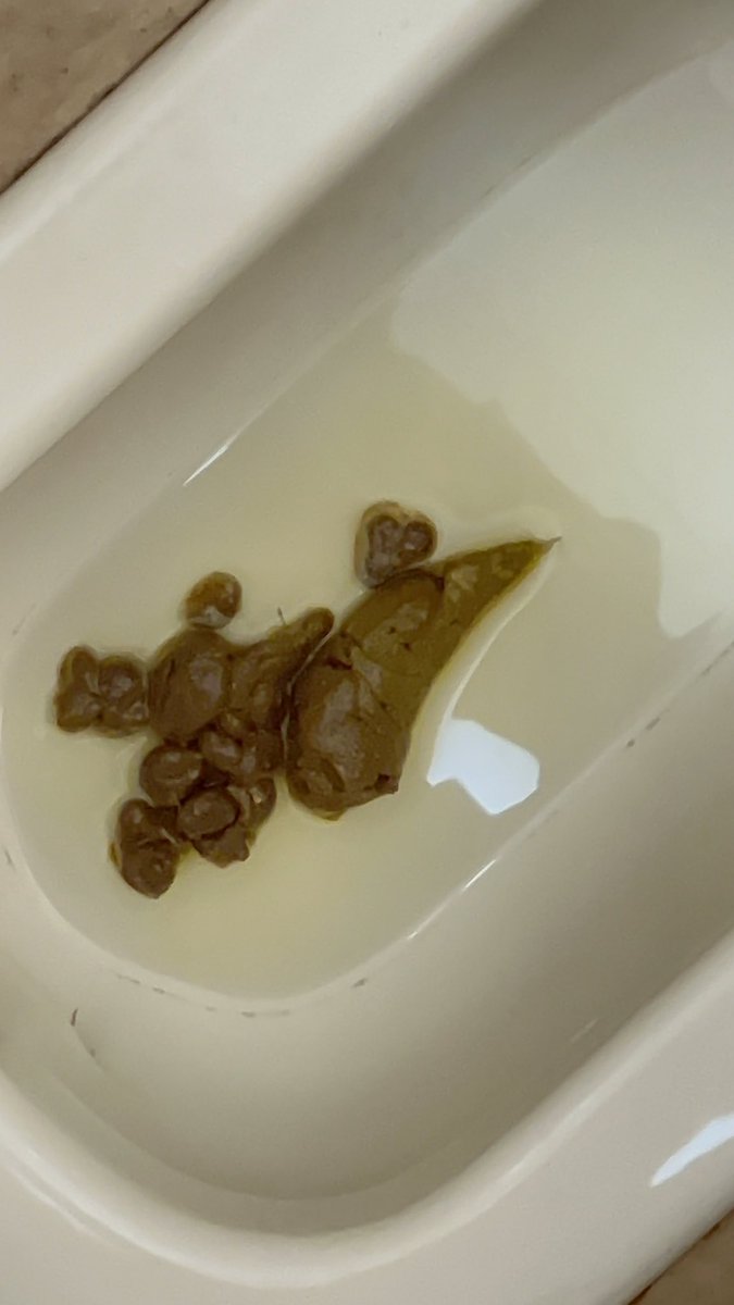 最近うんちの出が悪い〰️💦

職場のストレスかな🥺