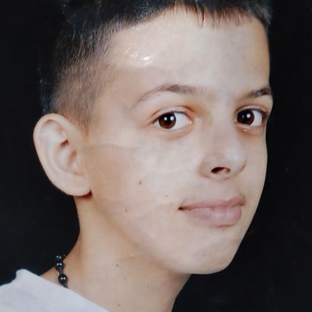 WOLPalestine's tweet image. Today we honor the memory of Mohammed Abu Khdeir, who was just 16 years old when he was kidnapped in Shuafat in occupied East Jerusalem, beaten, tortured, burned alive and brutally murdered by zionist settlers 11 years ago on July 2, 2014. 

NEVER FORGET! NEVER FORGIVE!