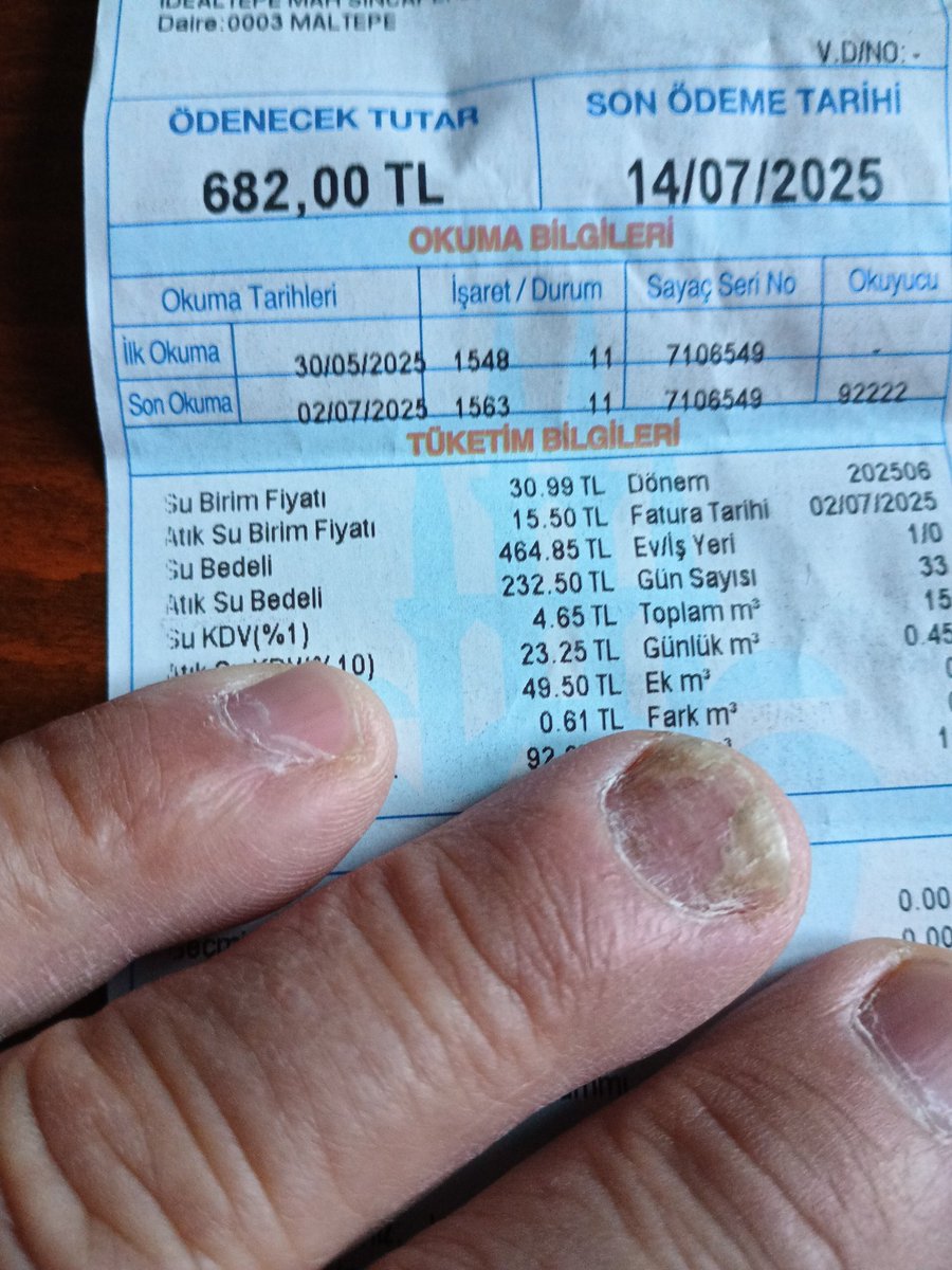 Eskiden su parası ni dert etmezdik,
Ancak su dan para mı alınır diyenler başkan olunca durum bu hale geldi.
Ama HAKKETTİİİK bunu.