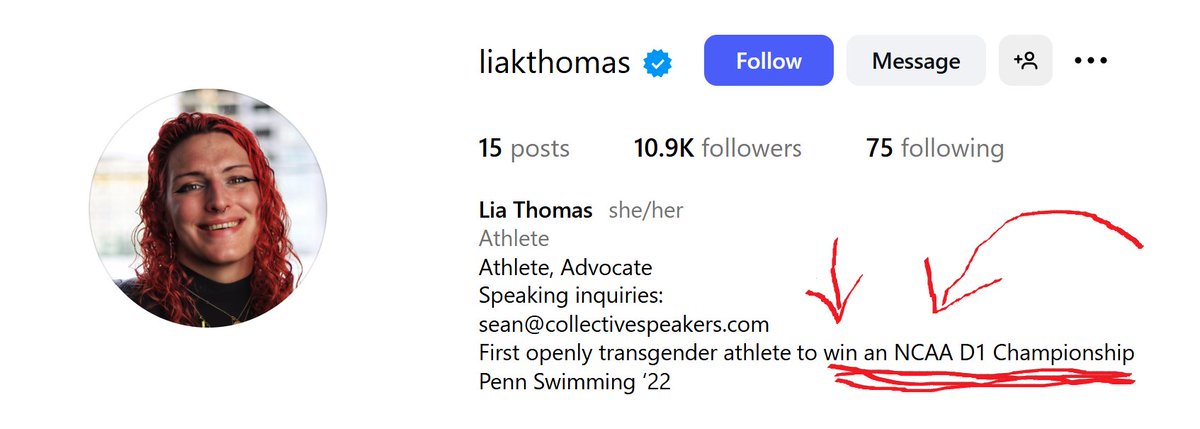 Um, Lia, you need to update your bio bro.