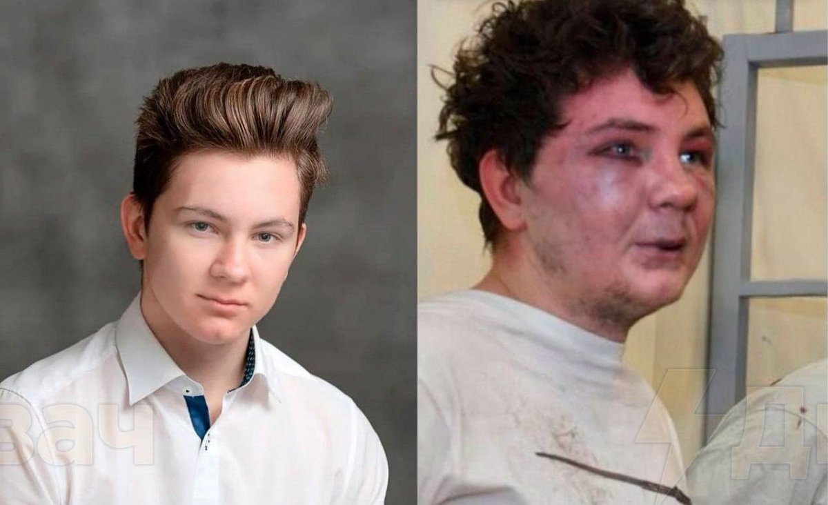 Когда местная кухня оказалась слишком острой и у тебя ебануло давление