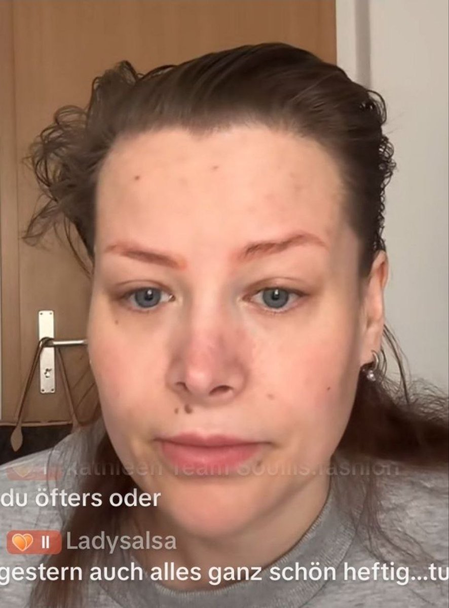 17er_Langnuss's tweet photo. Unser Tiktoksternchen #AlineBachmann wie Sie sich in ihren Stories zeigt vs wie sie wirklich aussieht!
🤣🤣🤣🤣🤣
#Catfish
#Filterqueen
#AllesFake
#Tilidin
#Betäubungsmittel https://t.co/r3kusIJsVm