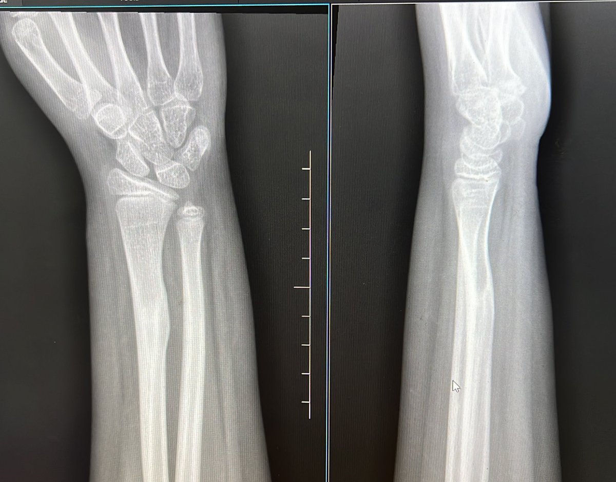 8 yr old remodelling in 8 months. 
<a href="/Davembmd/">dave</a>