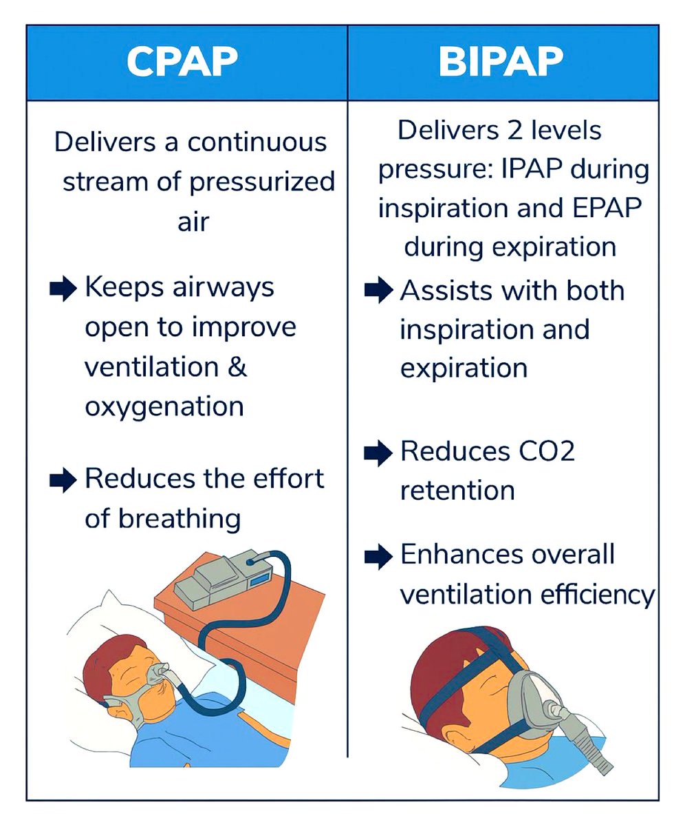 CPAP vs. BiPAP