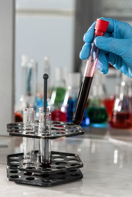 An epigenetic enzyme may play a key role in a particularly aggressive form of acute myeloid leukaemia in laboratory models, Japanese researchers have reported.

Read the latest #BSHNews story here: b-s-h.org.uk/about-us/news/…