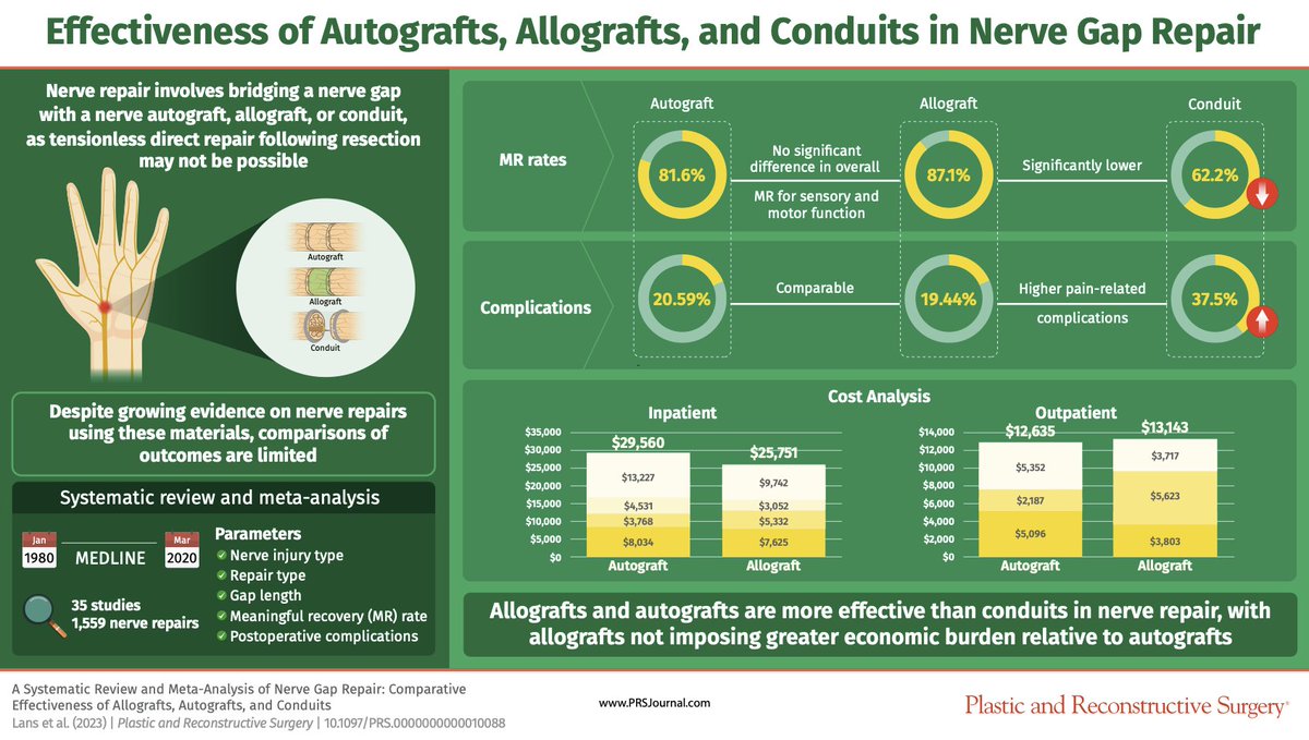 prsjournal's tweet image. 🔍 One of #PRSJournal’s most-cited articles!
Which #NerveRepair method delivers the best outcomes? A major meta-analysis compares autograft, allograft &amp;amp; conduit repairs—shedding light on recovery, complications &amp;amp; costs.
👉 Read now: l8r.it/deUv