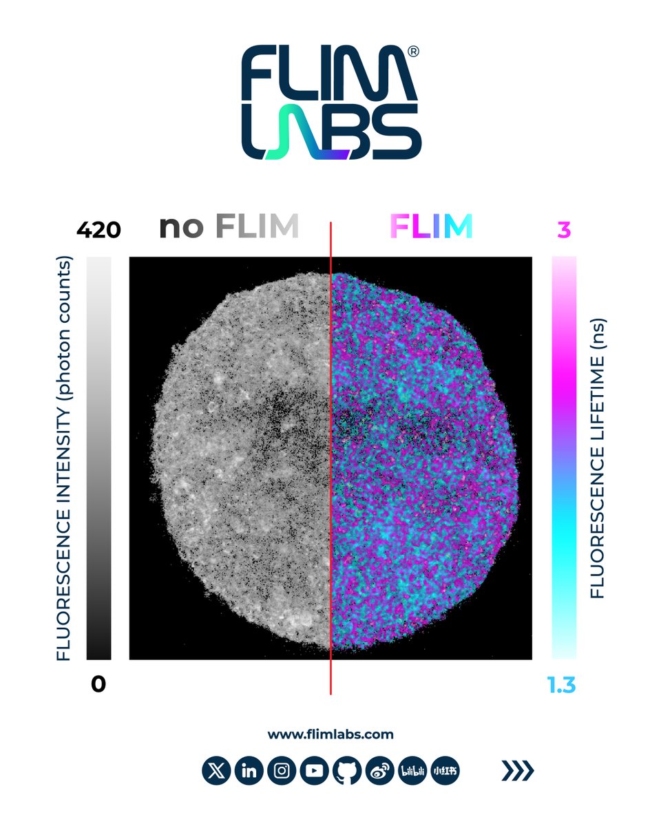 FlimLabs's tweet image. Has the Moon shrunk?! 🌕
Don’t worry — what you’re actually looking at are #tumorspheroids captured using the @bruker #Ultima #microscope setup combined with FLIM LABS' #FLIM upgrade!
If you want to know more about it: flimlabs.com/bruker-ultima/
