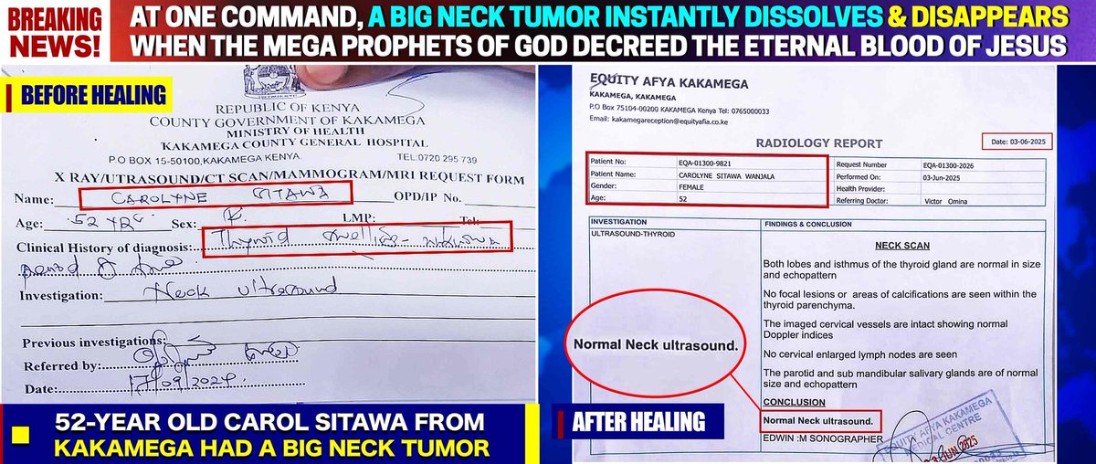 Breaking News Updates...

A BIG TUMOR instantly Dissolves and DISAPPEARS at One Command of The Eternal Blood of JESUS CHRIST by The Mega MIGHTIEST PROPHET OF YAHWEH Prophet Dr. Owuor.

Surely, THE MESSIAH is Coming.
Let us prepare The Way in Repentance and in Absolute Holiness.