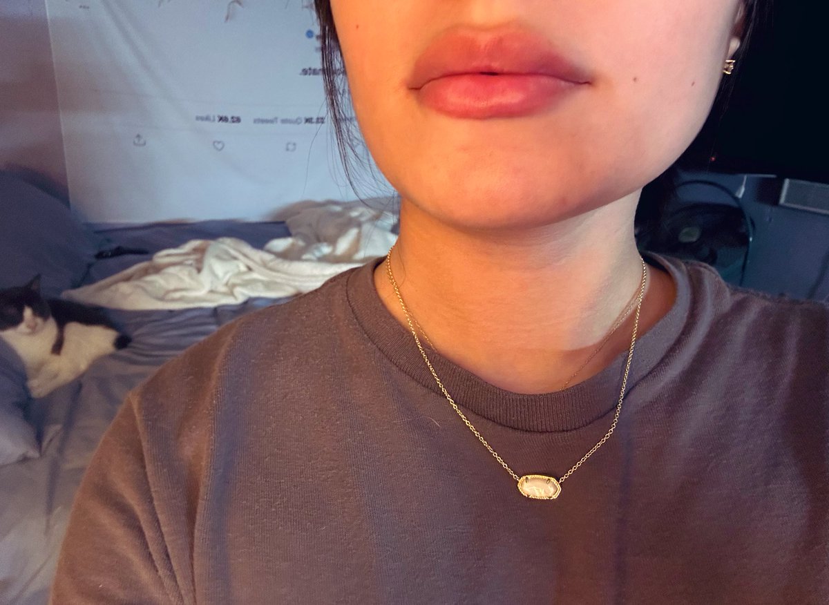 New boyfriend ✅New place✅New lips✅