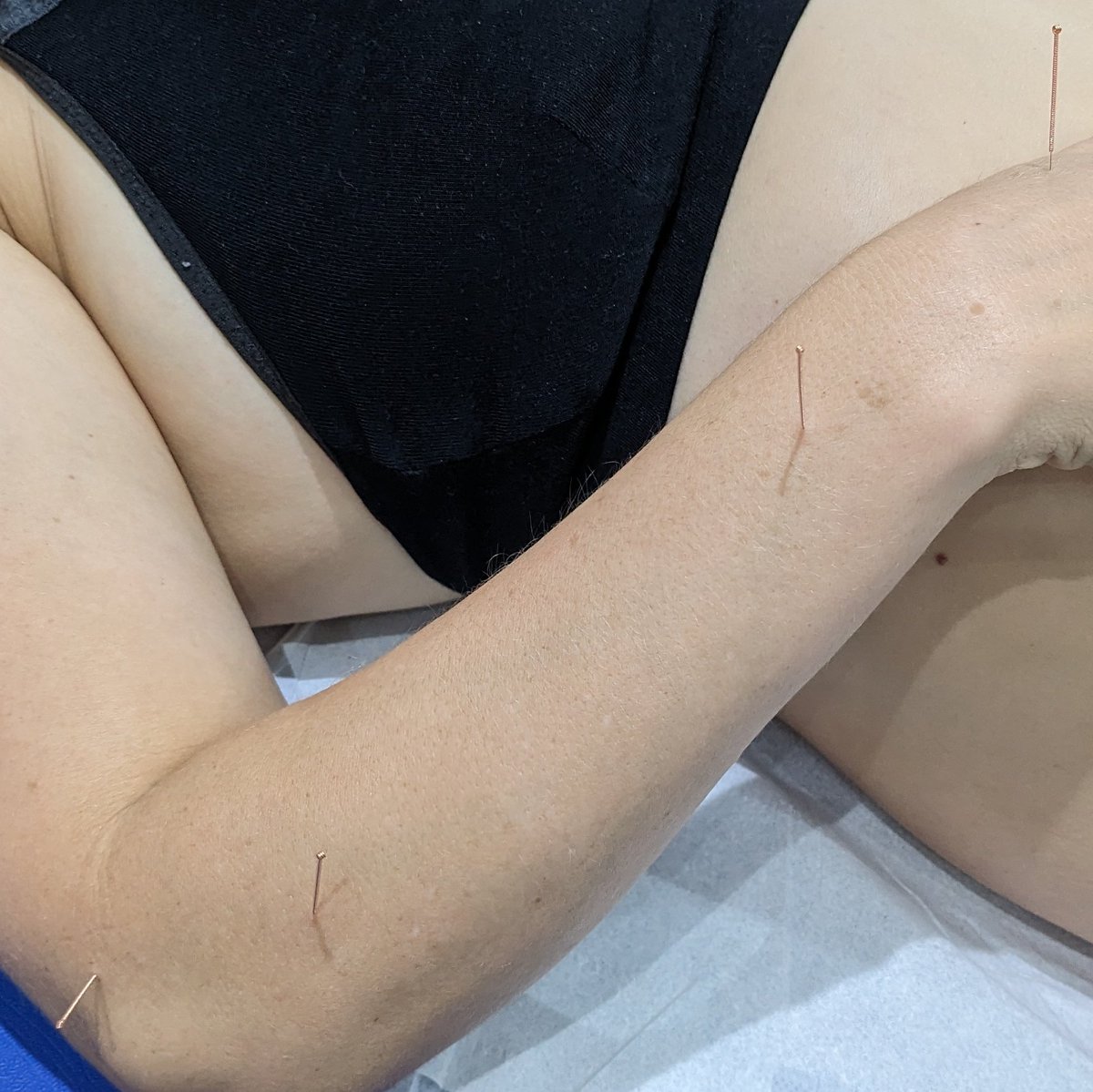 Holistic Massage in Charing Cross Glasgow G3 (@glasgowholistic) on Twitter photo 🪡 This weekend I'm in London training with <a href="/OMTtraining/">OMT Training</a> in Dry Needling — a targeted technique for muscle pain & mobility. Another step in bringing the best hands-on care to GHM. Can't wait to share this with you soon! #dryneedling #glasgowmassage #ghm #manualtherapy 🪡 This weekend I'm in London training with <a href="/OMTtraining/">OMT Training</a> in Dry Needling — a targeted technique for muscle pain & mobility. Another step in bringing the best hands-on care to GHM. Can't wait to share this with you soon! #dryneedling #glasgowmassage #ghm #manualtherapy
