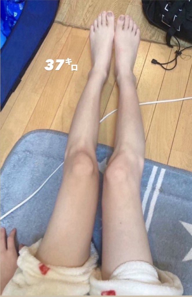 ｸｽﾘで14キロ痩せたけど、
多分今が人生で1番かわいい、特に足🦶🏻みて