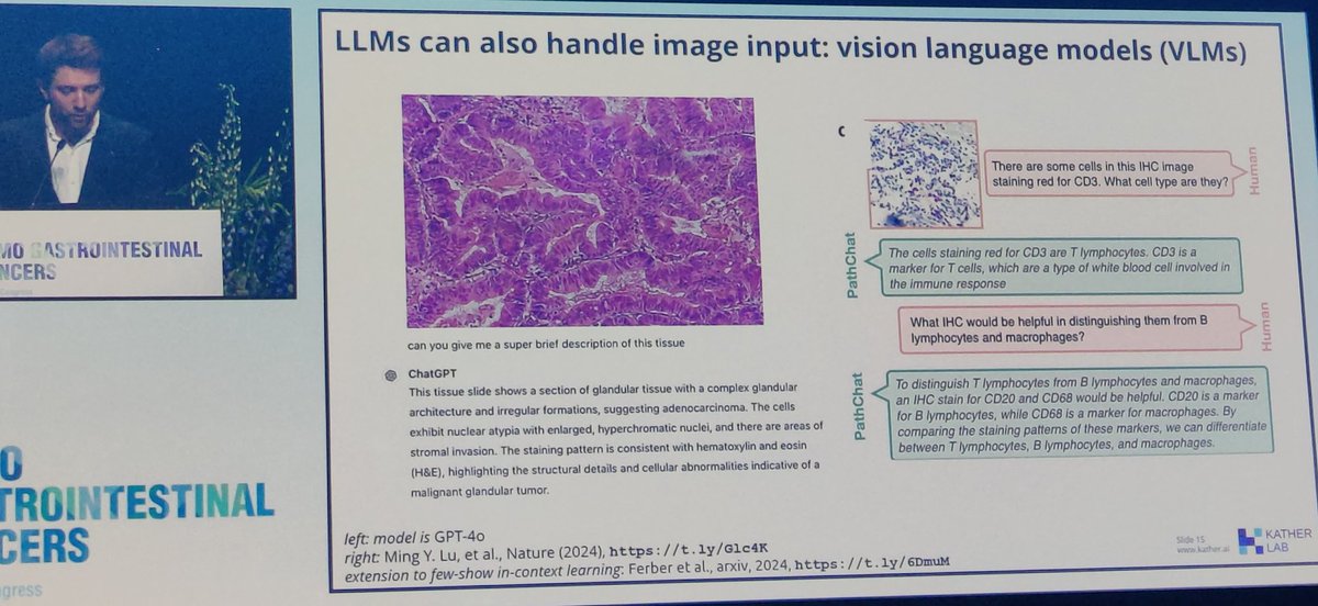 DrJorgeB_George (@drjorgebarriuso) on Twitter photo AI revolution coming to #ESMOGI25 Very interesting presentations from Prof Magali Svrcek and <a href="/jnkath/">Jakob Nikolas Kather</a> about the use and potential of #ArtificialIntelligence <a href="/myESMO/">ESMO - Eur. Oncology</a> #ESMOAmbassadors AI revolution coming to #ESMOGI25 Very interesting presentations from Prof Magali Svrcek and <a href="/jnkath/">Jakob Nikolas Kather</a> about the use and potential of #ArtificialIntelligence <a href="/myESMO/">ESMO - Eur. Oncology</a> #ESMOAmbassadors