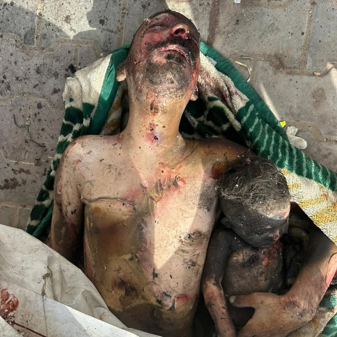 mdfazilanwar's tweet photo. @jacksonhinkle Mr. Trump, this genocide must stop now in Gaza . https://t.co/zCE2seV6Ki