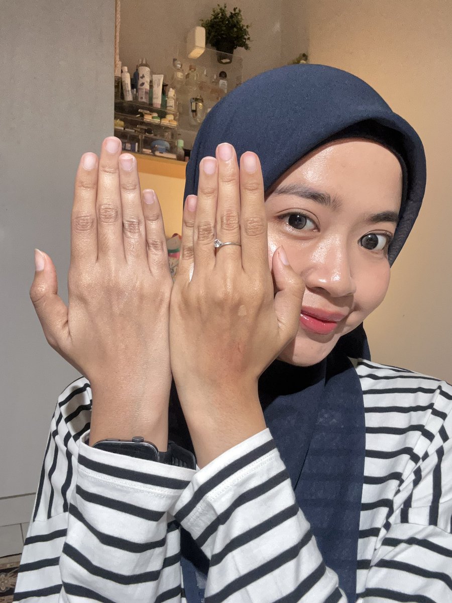 kforkinsley's tweet photo. Kalo makeup masih suka belang sama tangan, kata gw cobain body lotion tone up ini deh 😭✊🏻

produknya                          Hasilnya https://t.co/hzBuOHuFRm