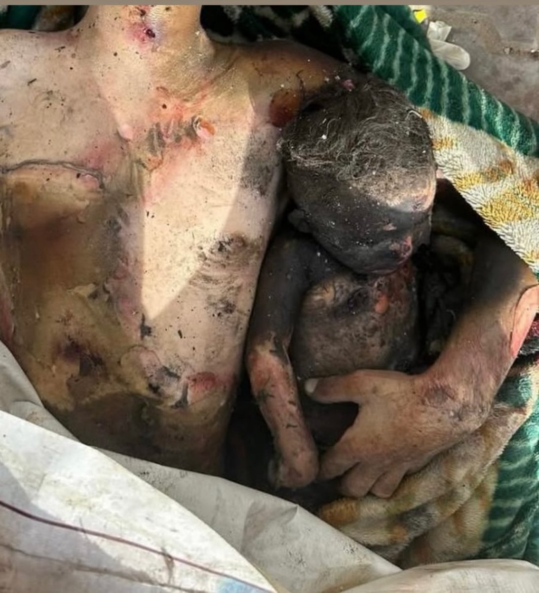A museum on the Gaza genocide will be built one day. A special section will be devoted to the complicity of Europe. One room will be titled "Israel has a right to defend itself." This picture of a Palestinian father clutching his month-old baby will hang there next to pictures of